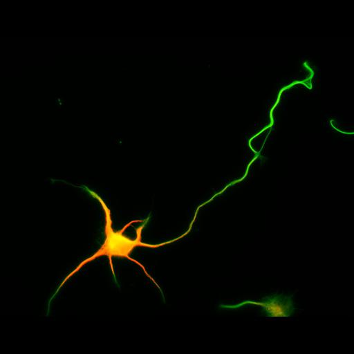  NCBI Organism:Rattus; Cell Types:multipolar neuron Cell Components:cytoskeleton, microtubule cytoskeleton, axon, dendrite; Biological process:cellular developmental process, dendrite development, establishment or maintenance of cell polarity;