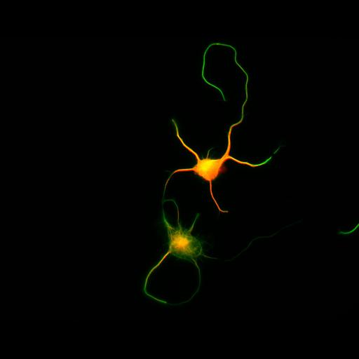  NCBI Organism:Rattus; Cell Types:multipolar neuron Cell Components:cytoskeleton, microtubule cytoskeleton, axon, dendrite; Biological process:cellular developmental process, dendrite development, establishment or maintenance of cell polarity;