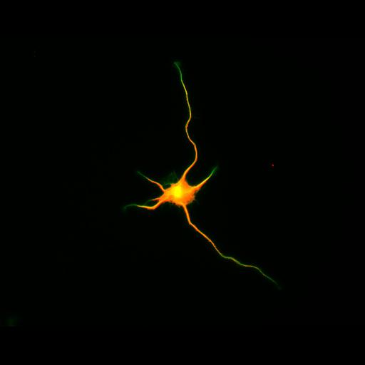  NCBI Organism:Rattus; Cell Types:multipolar neuron Cell Components:cytoskeleton, microtubule cytoskeleton, axon, dendrite; Biological process:cellular developmental process, dendrite development, establishment or maintenance of cell polarity;