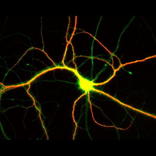  NCBI Organism:Rattus; Cell Types:multipolar neuron Cell Components:dendrite, microtubule cytoskeleton, axon, synapse; Biological process:cellular developmental process, dendrite development, establishment or maintenance of cell polarity;