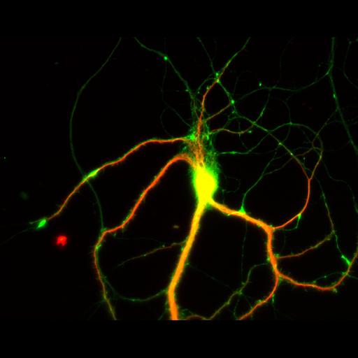  NCBI Organism:Rattus; Cell Types:multipolar neuron Cell Components:dendrite, microtubule cytoskeleton, axon, synapse; Biological process:cellular developmental process, dendrite development, establishment or maintenance of cell polarity;