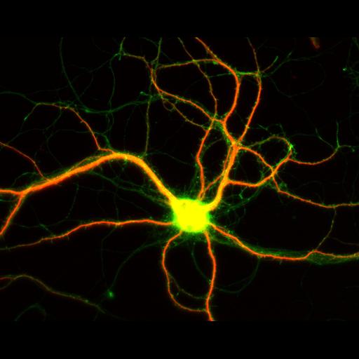  NCBI Organism:Rattus; Cell Types:multipolar neuron Cell Components:dendrite, microtubule cytoskeleton, axon, synapse; Biological process:cellular developmental process, dendrite development, establishment or maintenance of cell polarity;