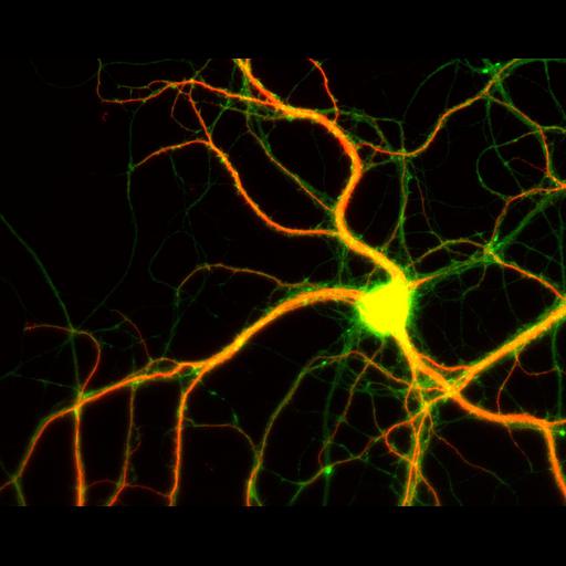  NCBI Organism:Rattus; Cell Types:multipolar neuron Cell Components:dendrite, microtubule cytoskeleton, axon, synapse; Biological process:cellular developmental process, dendrite development, establishment or maintenance of cell polarity;