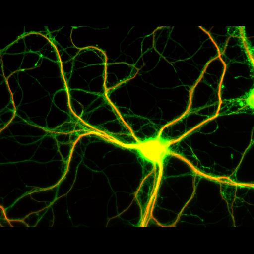  NCBI Organism:Rattus; Cell Types:multipolar neuron Cell Components:dendrite, microtubule cytoskeleton, axon, synapse; Biological process:cellular developmental process, dendrite development, establishment or maintenance of cell polarity;