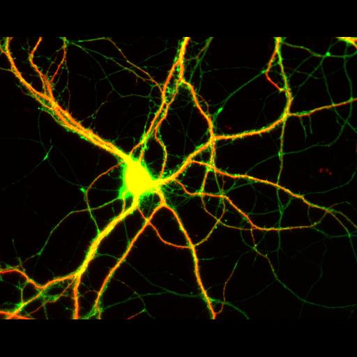  NCBI Organism:Rattus; Cell Types:multipolar neuron Cell Components:dendrite, microtubule cytoskeleton, axon, synapse; Biological process:cellular developmental process, dendrite development, establishment or maintenance of cell polarity;