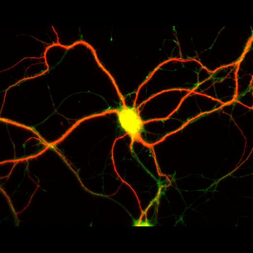  NCBI Organism:Rattus; Cell Types:multipolar neuron Cell Components:dendrite, microtubule cytoskeleton, axon, synapse; Biological process:cellular developmental process, dendrite development, establishment or maintenance of cell polarity;