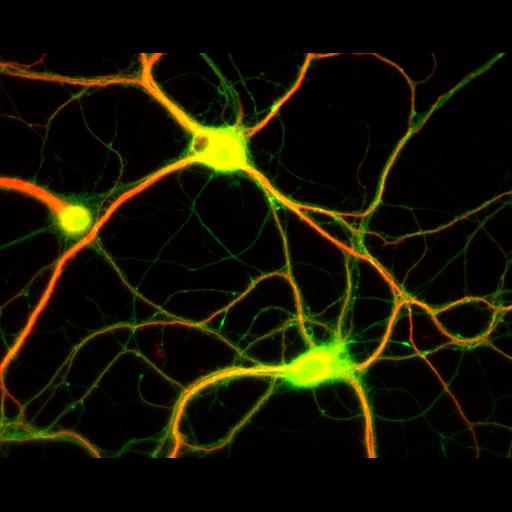  NCBI Organism:Rattus; Cell Types:multipolar neuron Cell Components:dendrite, microtubule cytoskeleton, axon, synapse; Biological process:cellular developmental process, dendrite development, establishment or maintenance of cell polarity;