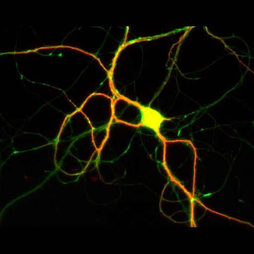  NCBI Organism:Rattus; Cell Types:multipolar neuron Cell Components:dendrite, microtubule cytoskeleton, axon, synapse; Biological process:cellular developmental process, dendrite development, establishment or maintenance of cell polarity;