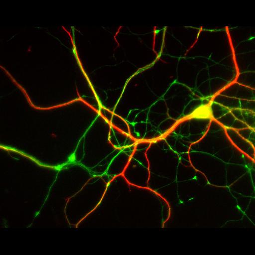  NCBI Organism:Rattus; Cell Types:multipolar neuron Cell Components:dendrite, microtubule cytoskeleton, axon, synapse; Biological process:cellular developmental process, dendrite development, establishment or maintenance of cell polarity;