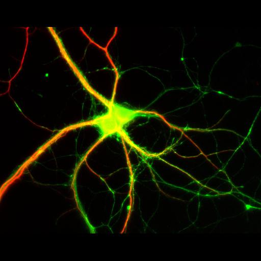  NCBI Organism:Rattus; Cell Types:multipolar neuron Cell Components:dendrite, microtubule cytoskeleton, axon, synapse; Biological process:cellular developmental process, dendrite development, establishment or maintenance of cell polarity;