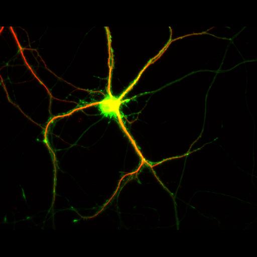  NCBI Organism:Rattus; Cell Types:multipolar neuron Cell Components:dendrite, microtubule cytoskeleton, axon, synapse; Biological process:cellular developmental process, dendrite development, establishment or maintenance of cell polarity;