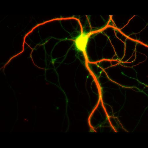  NCBI Organism:Rattus; Cell Types:multipolar neuron Cell Components:dendrite, microtubule cytoskeleton, axon, synapse; Biological process:cellular developmental process, dendrite development, establishment or maintenance of cell polarity;