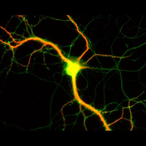  NCBI Organism:Rattus; Cell Types:multipolar neuron Cell Components:dendrite, microtubule cytoskeleton, axon, synapse; Biological process:cellular developmental process, dendrite development, establishment or maintenance of cell polarity;