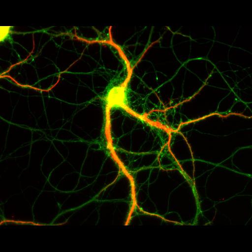  NCBI Organism:Rattus; Cell Types:multipolar neuron Cell Components:dendrite, microtubule cytoskeleton, axon, synapse; Biological process:cellular developmental process, dendrite development, establishment or maintenance of cell polarity;