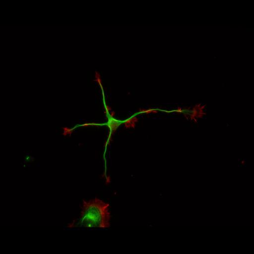  NCBI Organism:Rattus; Cell Types:multipolar neuron Cell Components:cytoskeleton, microtubule cytoskeleton, actin cytoskeleton, axon, dendrite, dendritic growth cone, axonal growth cone, lamellipodium, filopodium; Biological process:developmental process, dendrite development, establishment or maintenance of cell polarity;