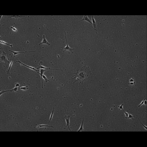  NCBI Organism:Mus musculus; Cell Types:permanent cell line cell Cell Components:cell, nucleus, extracellular matrix part; Biological process:localization, cellular localization, cell adhesion;