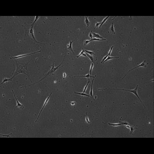  NCBI Organism:Mus musculus; Cell Types:permanent cell line cell Cell Components:cell, nucleus, extracellular matrix part; Biological process:localization, cellular localization, cell adhesion;