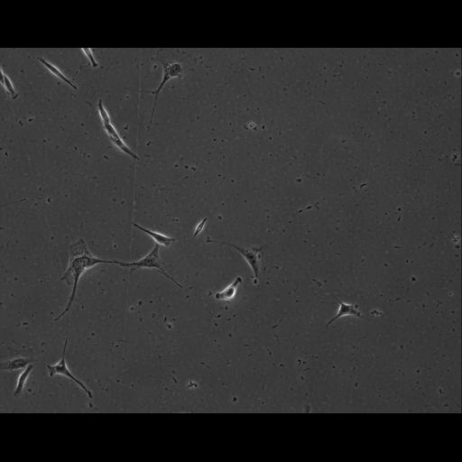  NCBI Organism:Mus musculus; Cell Types:permanent cell line cell Cell Components:cell, nucleus, extracellular matrix part; Biological process:localization, cellular localization, cell adhesion;