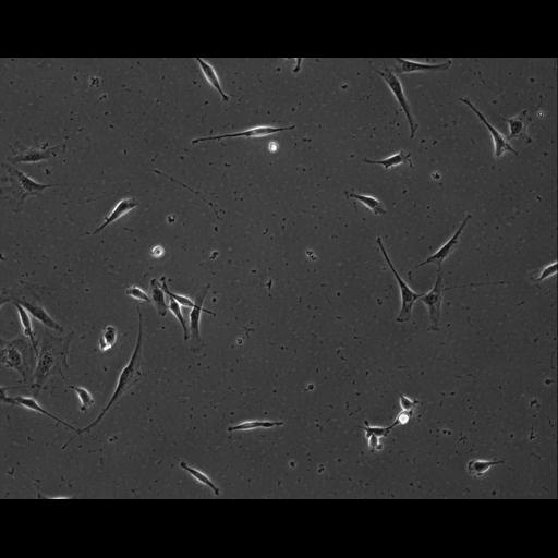  NCBI Organism:Mus musculus; Cell Types:permanent cell line cell Cell Components:cell, nucleus, extracellular matrix part; Biological process:localization, cellular localization, cell adhesion;