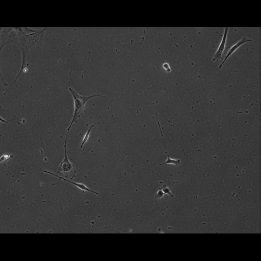  NCBI Organism:Mus musculus; Cell Types:permanent cell line cell Cell Components:cell, nucleus, extracellular matrix part; Biological process:localization, cellular localization, cell adhesion;