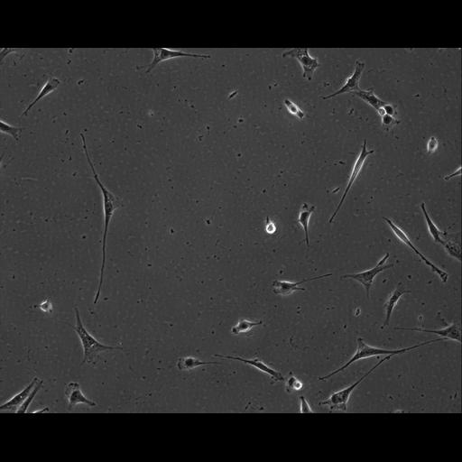  NCBI Organism:Mus musculus; Cell Types:permanent cell line cell Cell Components:cell, nucleus, extracellular matrix part; Biological process:localization, cellular localization, cell adhesion;