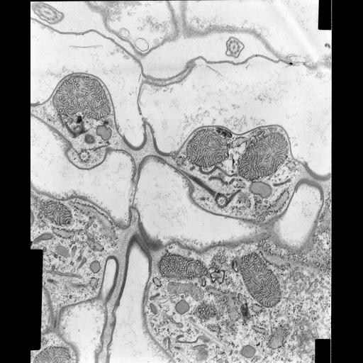  NCBI Organism:Coleps hirtus; Cell Types:eukaryotic cell, , ; Cell Components:cilium axoneme, microtubule basal body, axonemal microtubule, plasma membrane, cytoskeleton, microtubule cytoskeleton, actin cytoskeleton, , ; Biological process:ciliary or flagellar motility, microtubule cytoskeleton organization, ;