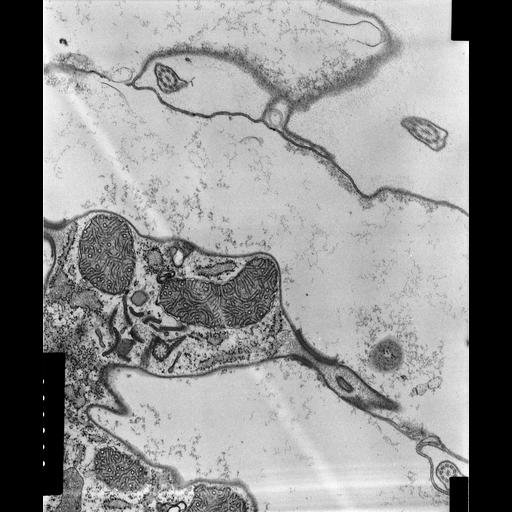  NCBI Organism:Coleps hirtus; Cell Types:eukaryotic cell, , ; Cell Components:cortical cytoskeleton, microtubule basal body, , plasma membrane, cytoskeleton, microtubule cytoskeleton, , ; Biological process:ciliary or flagellar motility, microtubule cytoskeleton organization;