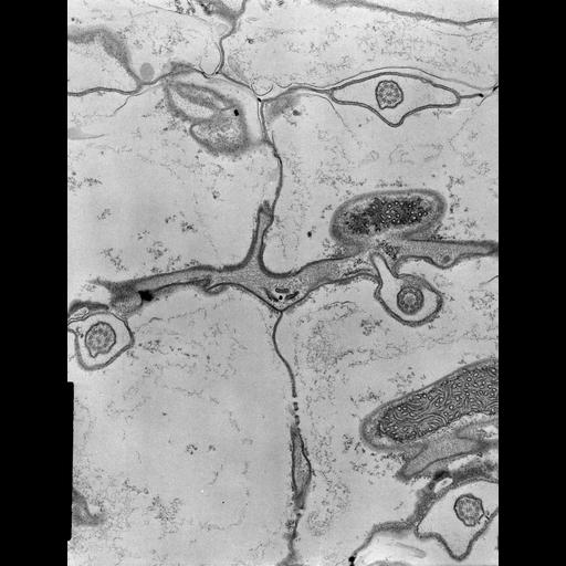  NCBI Organism:Coleps hirtus; Cell Types:eukaryotic cell, , ; Cell Components:plasma membrane, , motile primary cilium, axonemal microtubule, axonemal dynein complex; Biological process:, ciliary or flagellar motility, microtubule cytoskeleton organization;