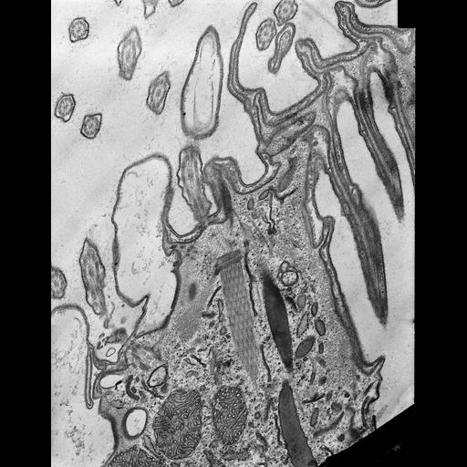  NCBI Organism:Coleps hirtus; Cell Types:eukaryotic cell, , ; Cell Components:, plasma membrane, microtubule basal body, cytoskeleton, microtubule cytoskeleton, actin cytoskeleton; Biological process:digestive system process, microtubule cytoskeleton organization, ;