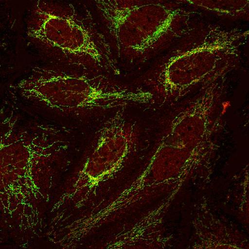  NCBI Organism:Homo sapiens; Cell Components:mitochondrial outer membrane, ; Biological process:G1/S transition of mitotic cell cycle