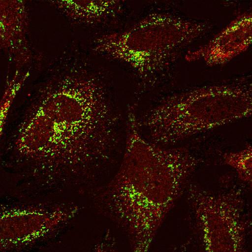  NCBI Organism:Homo sapiens; Cell Components:mitochondrial outer membrane, ; Biological process:G1/S transition of mitotic cell cycle