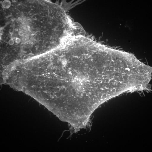  NCBI Organism:Homo sapiens; Cell Types:permanent cell line cell, epithelial cell; Cell Components:anchored to plasma membrane Biological process:cellular membrane organization