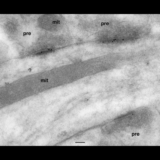  NCBI Organism:Rattus; Cell Types:interneuron Cell Components:mitochondrion, , dendrite, ; Biological process:protein localization to synapse