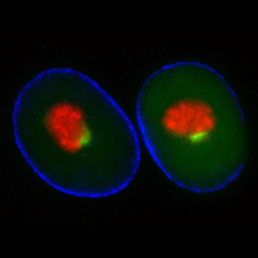  NCBI Organism:Homo sapiens; Cell Components:nucleolus Biological process:RNA metabolic process