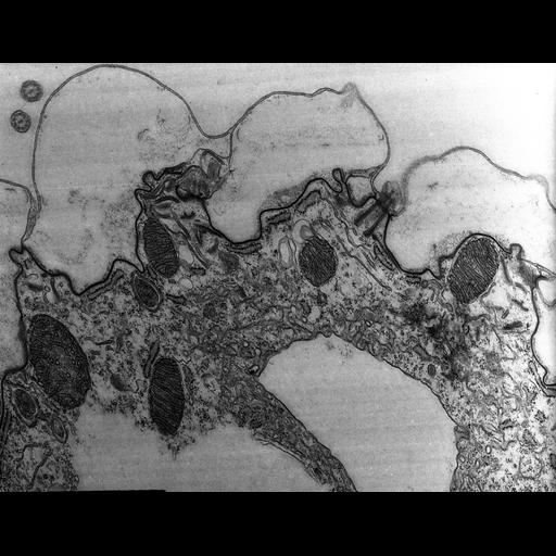  NCBI Organism:Coleps hirtus; Cell Types:cell by organism, eukaryotic cell, , ; Cell Components:contractile vacuole, smooth endoplasmic reticulum membrane, mitochondrion, mitochondrial outer membrane, mitochondrial inner membrane, , ; Biological process:cellular water homeostasis, long-chain fatty acid metabolic process, oxidative phosphorylation;