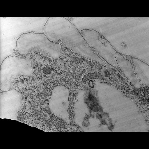  NCBI Organism:Coleps hirtus; Cell Types:, ; Cell Components:contractile vacuole, contractile vacuolar membrane, , ; Biological process:water transport, response to water, ;