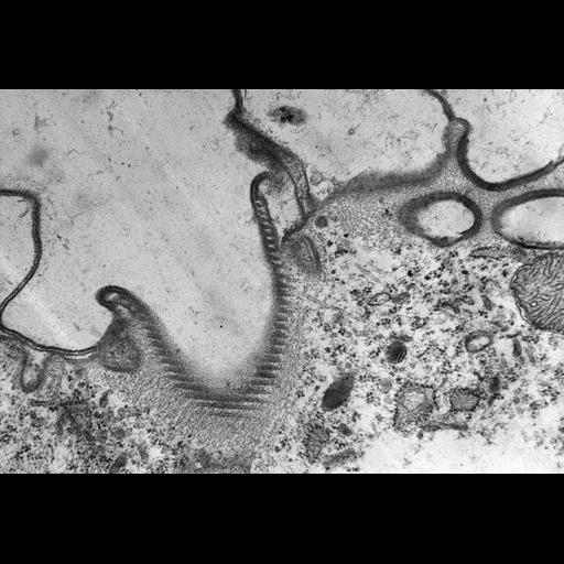  NCBI Organism:Coleps hirtus; Cell Types:, ; Cell Components:contractile vacuole pore, microtubule associated complex, axonemal dynein complex, plasma membrane, cytoskeleton, actin cytoskeleton; Biological process:water homeostasis, microtubule cytoskeleton organization, ;