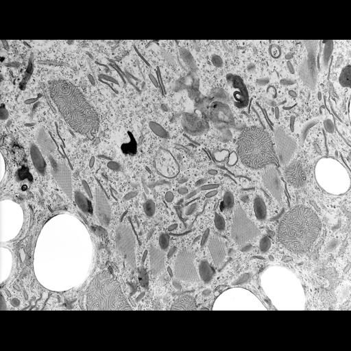  NCBI Organism:Coleps hirtus; Cell Types:eukaryotic cell, , ; Cell Components:oral apparatus, microtubule associated complex, ; Biological process:, digestion;