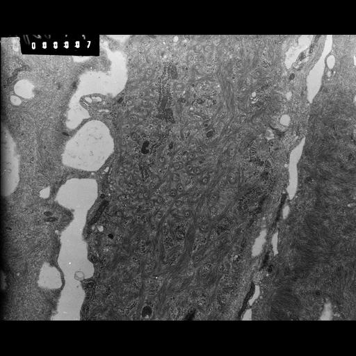  NCBI Organism:Rana catesbeiana; Cell Types:barrier epithelial cell Cell Components:intermediate filament cytoskeleton, plasma membrane; Biological process:intermediate filament cytoskeleton organization