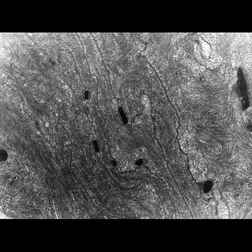  NCBI Organism:Rana catesbeiana; Cell Types:barrier epithelial cell Cell Components:intermediate filament cytoskeleton, plasma membrane; Biological process:intermediate filament cytoskeleton organization