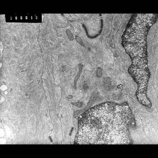  NCBI Organism:Rana catesbeiana; Cell Types:barrier epithelial cell Cell Components:intermediate filament cytoskeleton, plasma membrane; Biological process:intermediate filament cytoskeleton organization