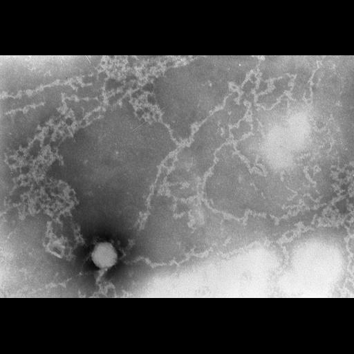  Cell Types:erythrocyte Cell Components:nuclear chromatin Biological process:DNA packaging