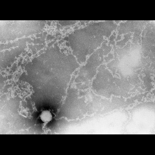  Cell Types:erythrocyte Cell Components:nuclear chromatin Biological process:DNA packaging