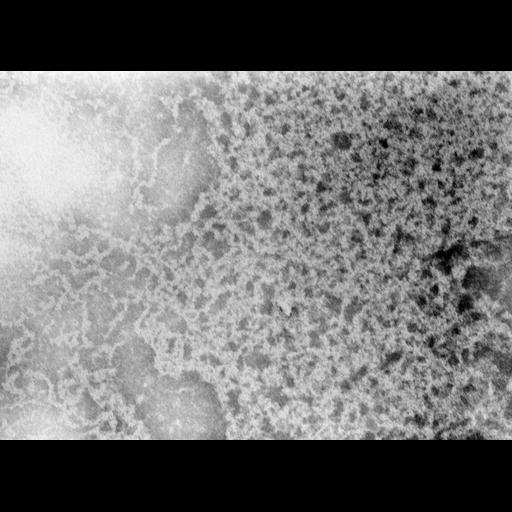  Cell Types:erythrocyte Cell Components:nuclear chromatin Biological process:DNA packaging