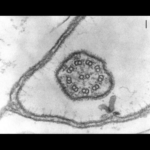  NCBI Organism:Coleps hirtus; Cell Types:eukaryotic cell, , ; Cell Components:cilium axoneme, axonemal microtubule, axonemal dynein complex, glycocalyx; Biological process:ciliary or flagellar motility, protein galactosylation at cell surface;