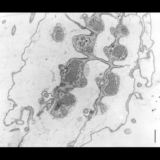  NCBI Organism:Coleps hirtus; Cell Types:eukaryotic cell, , ; Cell Components:plasma membrane, , , , cilium; Biological process:, ciliary or flagellar motility;