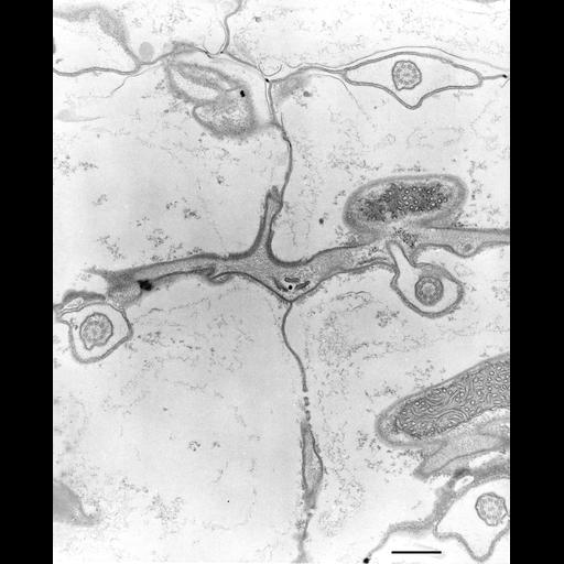  NCBI Organism:Coleps hirtus; Cell Types:eukaryotic cell, , ; Cell Components:plasma membrane, , motile primary cilium, axonemal microtubule, axonemal dynein complex; Biological process:, ciliary or flagellar motility, microtubule cytoskeleton organization;