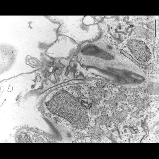  NCBI Organism:Coleps hirtus; Cell Types:eukaryotic cell, , ; Cell Components:cell cortex, rough endoplasmic reticulum, polysome, plasma membrane; Biological process:, vesicle targeting, rough ER to cis-Golgi;