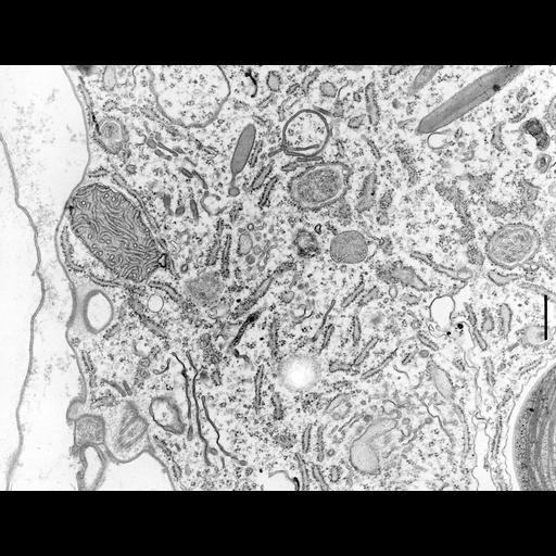  NCBI Organism:Coleps hirtus; Cell Types:eukaryotic cell, , ; Cell Components:rough endoplasmic reticulum membrane, smooth endoplasmic reticulum, mitochondrion, peroxisome, plasma membrane, , symbiont-containing vacuole, , ; Biological process:regulation of cellular metabolic process, , detection of symbiotic bacterium, , detection of symbiont;