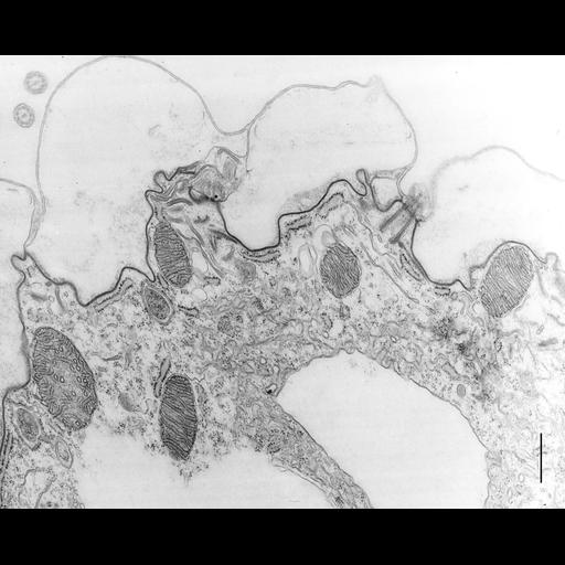  NCBI Organism:Coleps hirtus; Cell Types:cell by organism, eukaryotic cell, , ; Cell Components:contractile vacuole, smooth endoplasmic reticulum membrane, mitochondrion, mitochondrial outer membrane, mitochondrial inner membrane, , ; Biological process:cellular water homeostasis, long-chain fatty acid metabolic process, oxidative phosphorylation;